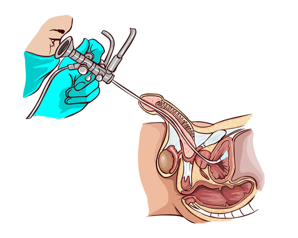 UROGEN - clínica de urologia e ginecologia endoscópica