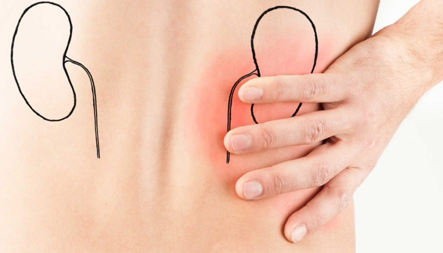 Dor Rins dor-rins - UROBH - Urologia Minimamente Invasiva
