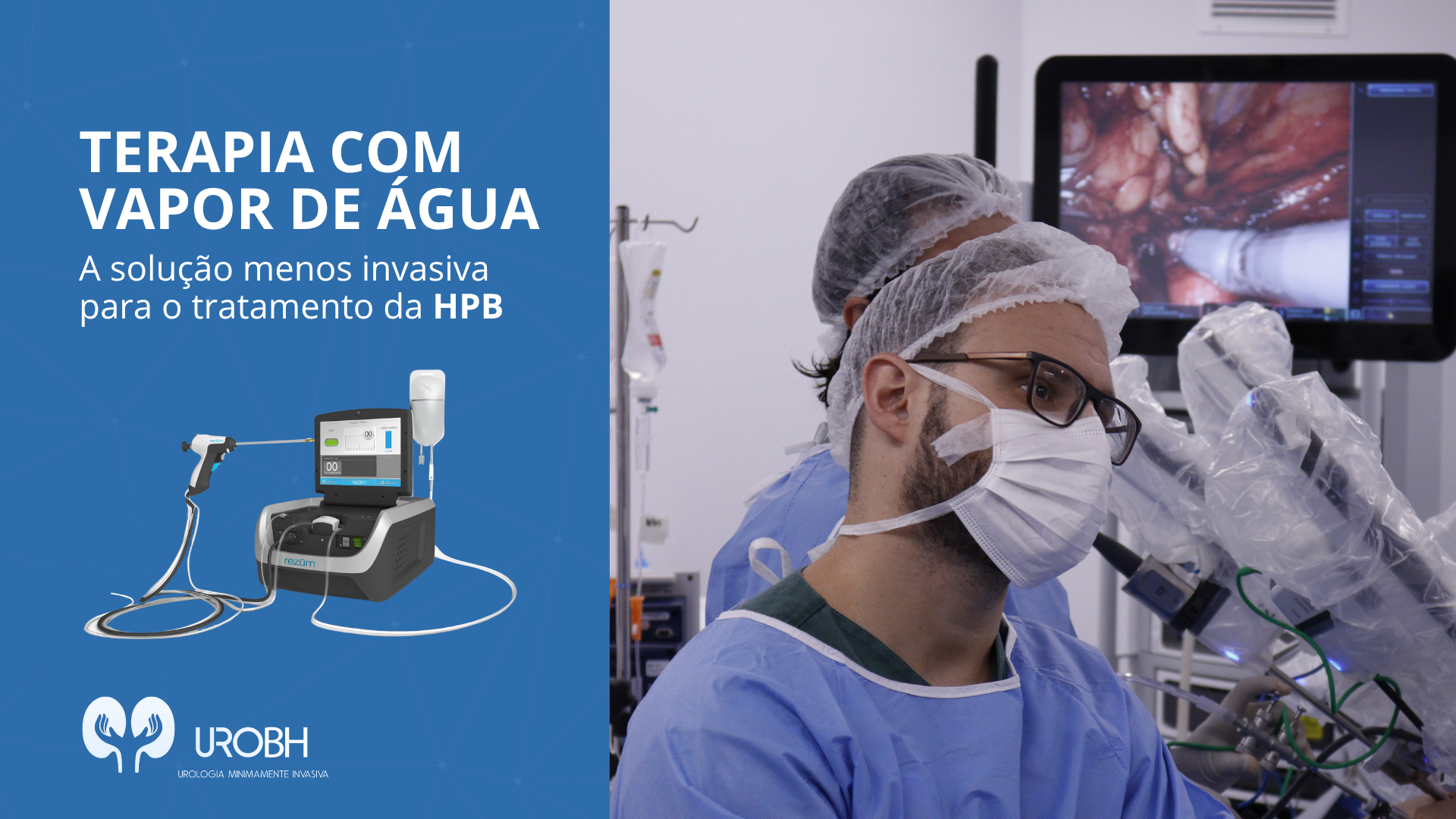 TERAPIA COM VAPOR DE ÁGUA: A SOLUÇÃO MENOS INVASIVA PARA O TRATAMENTO DA HPB TERAPIA COM VAPOR DE ÁGUA: A SOLUÇÃO MENOS INVASIVA PARA O TRATAMENTO DA HPB