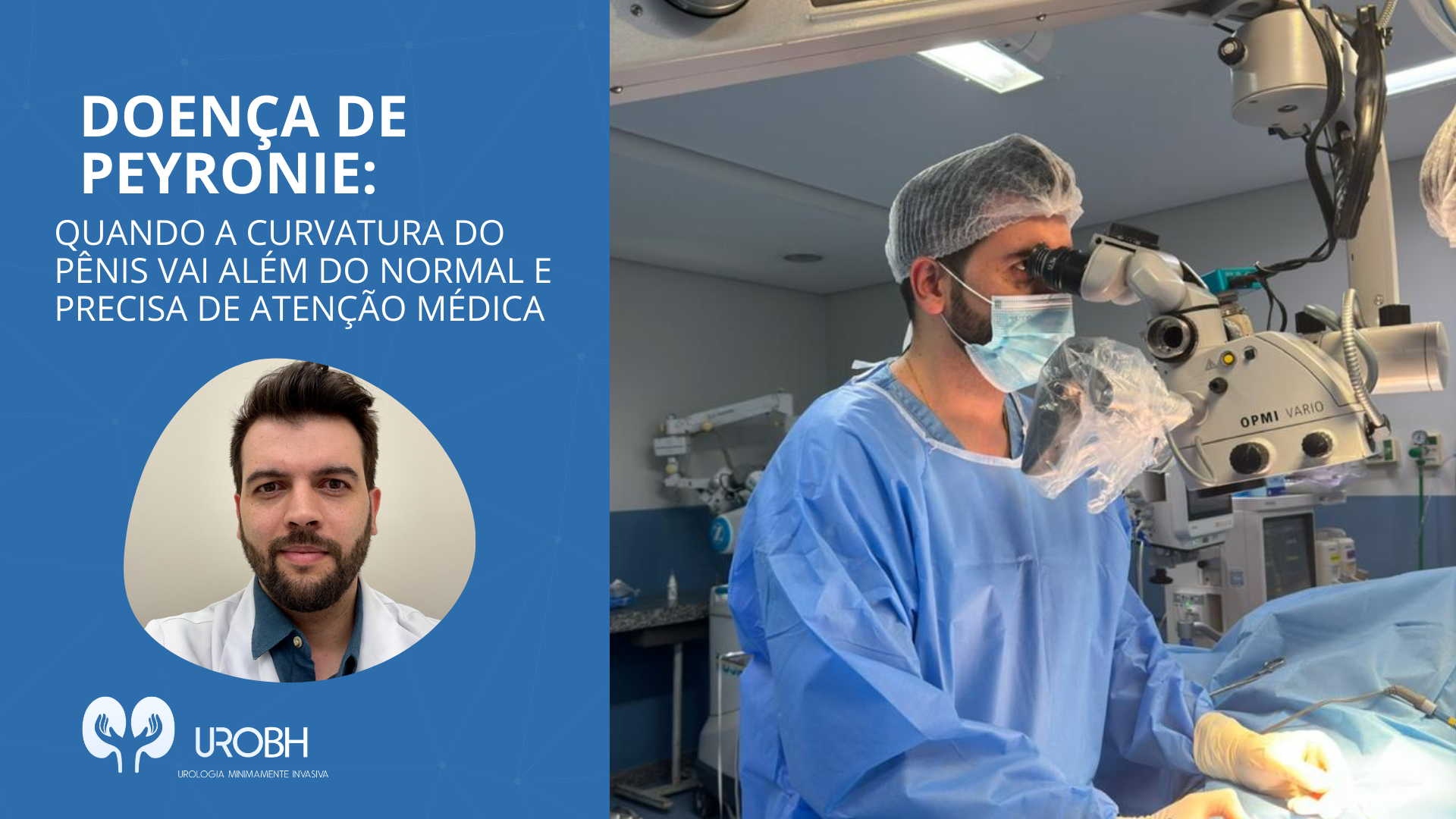 DOENÇA DE PEYRONIE: QUANDO A CURVATURA DO PÊNIS VAI ALÉM DO NORMAL E PRECISA DE ATENÇÃO MÉDICA