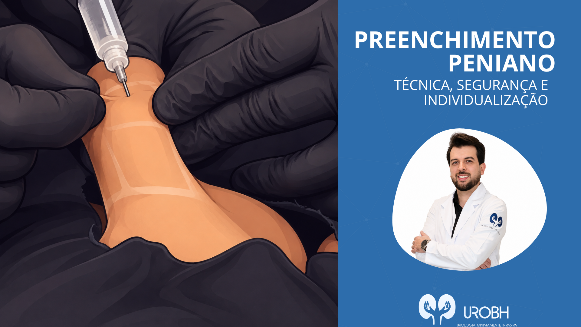 PREENCHIMENTO PENIANO: TÉCNICA, SEGURANÇA E INDIVIDUALIZAÇÃO